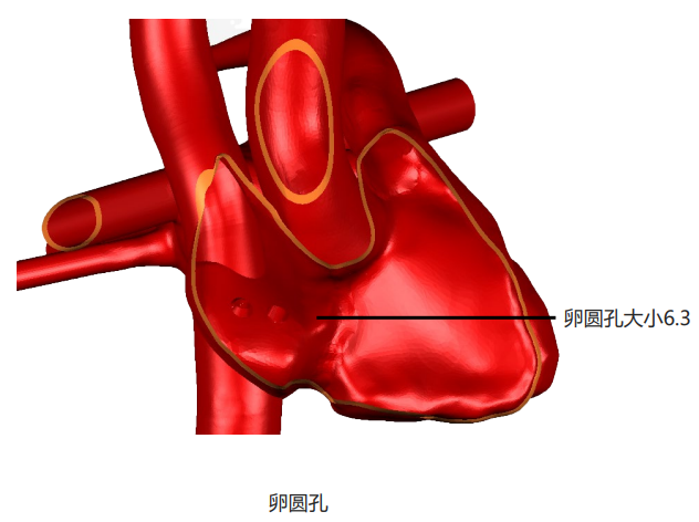 1a4e323b-bcb5-45d3-b963-77e41d500307
